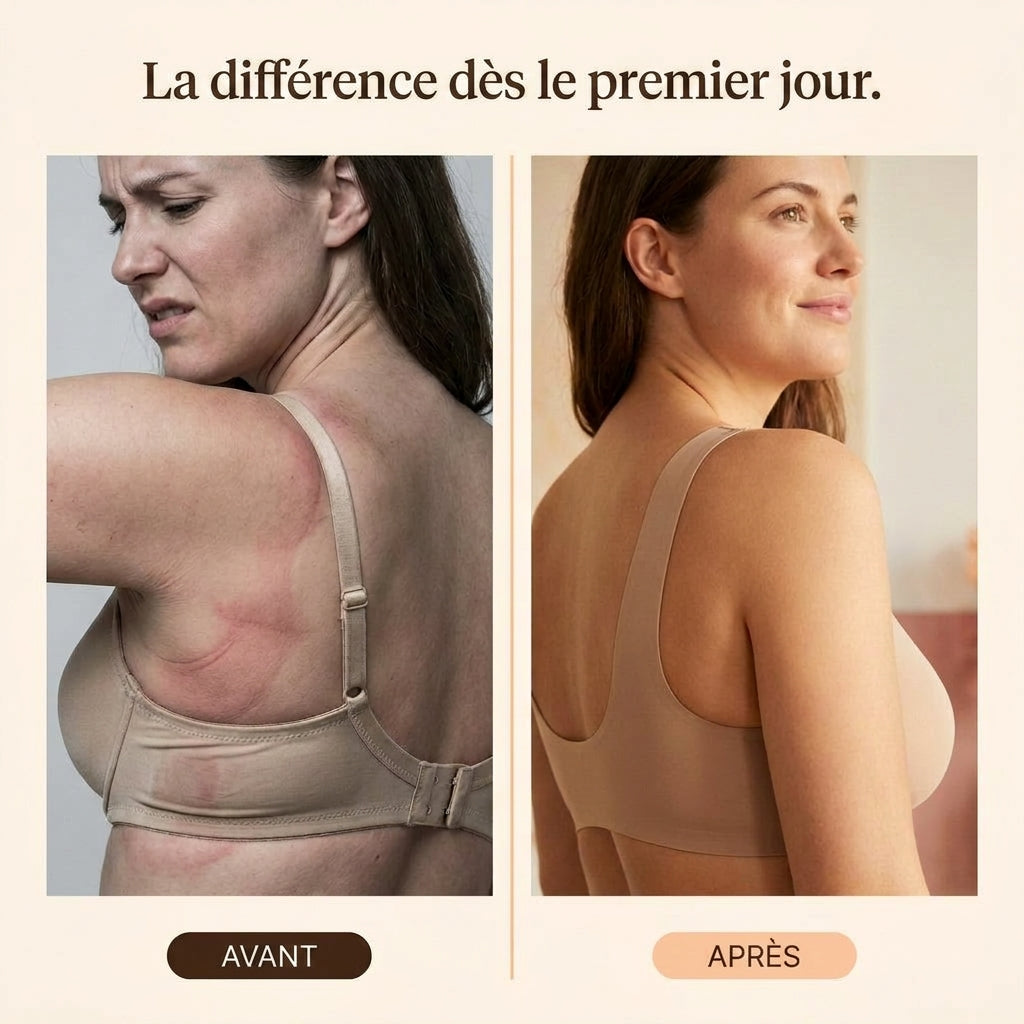 Pielma Lift 3D · FR · 3-before-after-sensation
